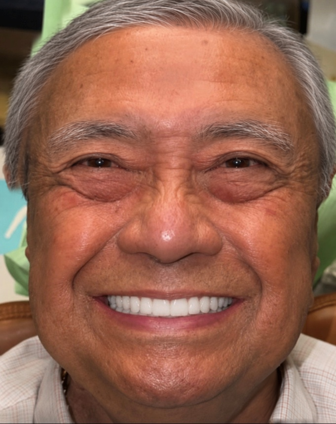 Una sonrisa frente al desgaste. · después