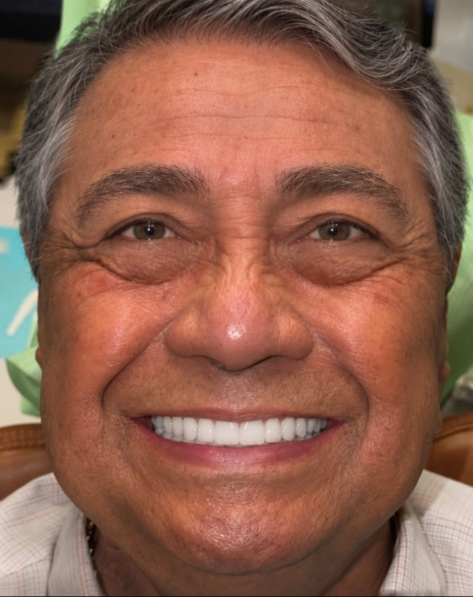 Una sonrisa frente al desgaste. · después